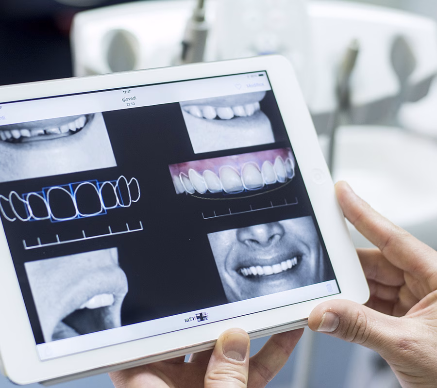Digital smile design odontoiatria estetica digitale