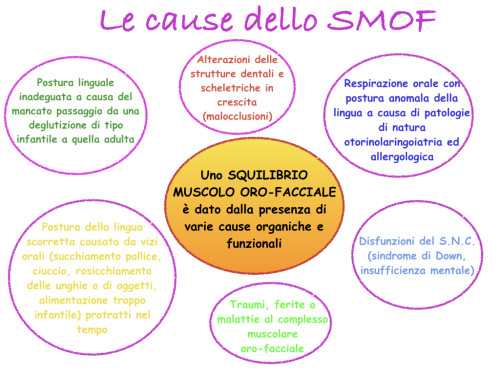 Cause dello SMOF.001