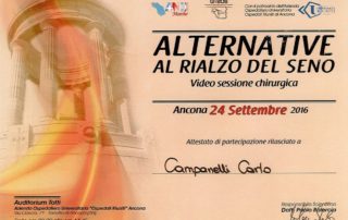 Alternative al rialzo del seno